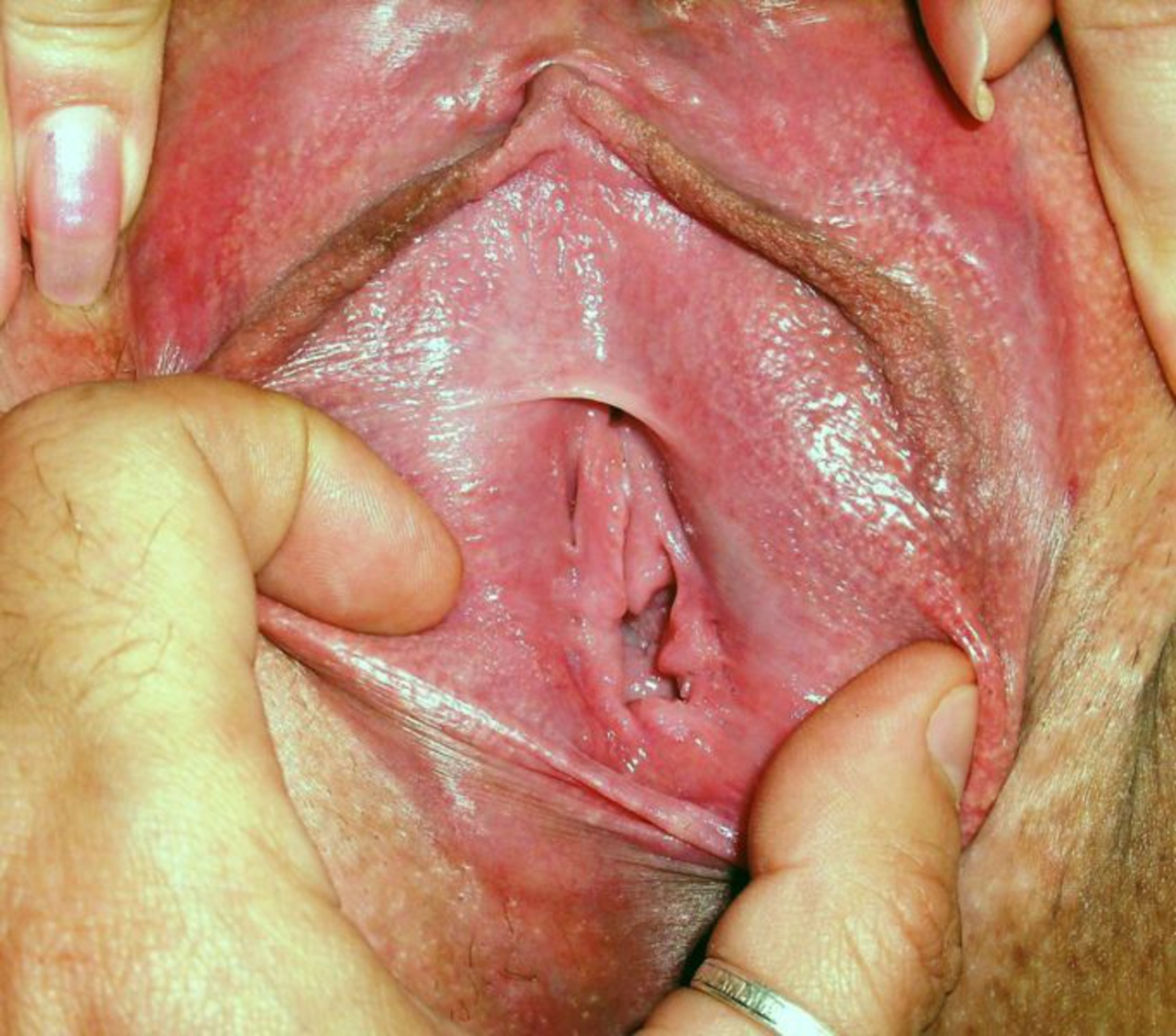 Gerbil inside vagina