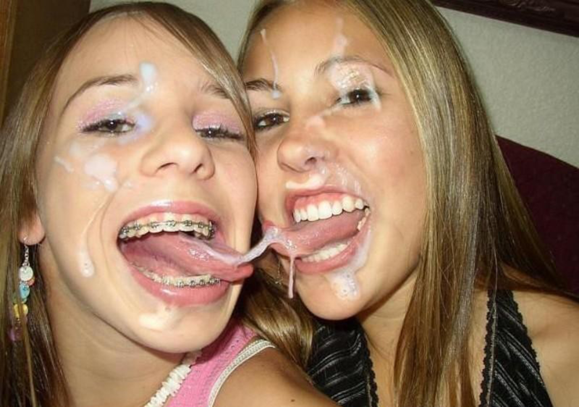 Naked Girls With Braces Anal