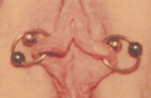 #2