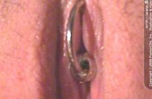 #31