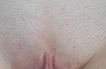 #33