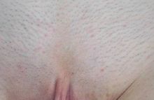 #35