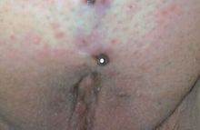 #13