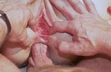 #11