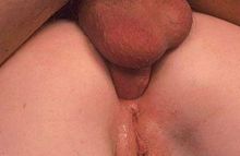 #31