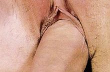 #9