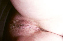 #33