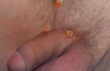 #9