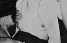 #35