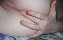 #3