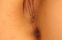 #14