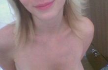 #87