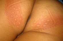 #36