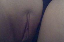 #18