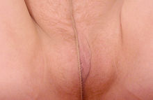 #31